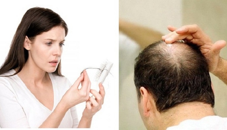Tóc bạn đang bị rụng đang tình trạng rụng ngày một nhiều hơn, giải pháp làm sao để ngăn rụng bây giờ?